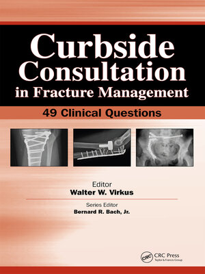 cover image of Curbside Consultation in Fracture Management